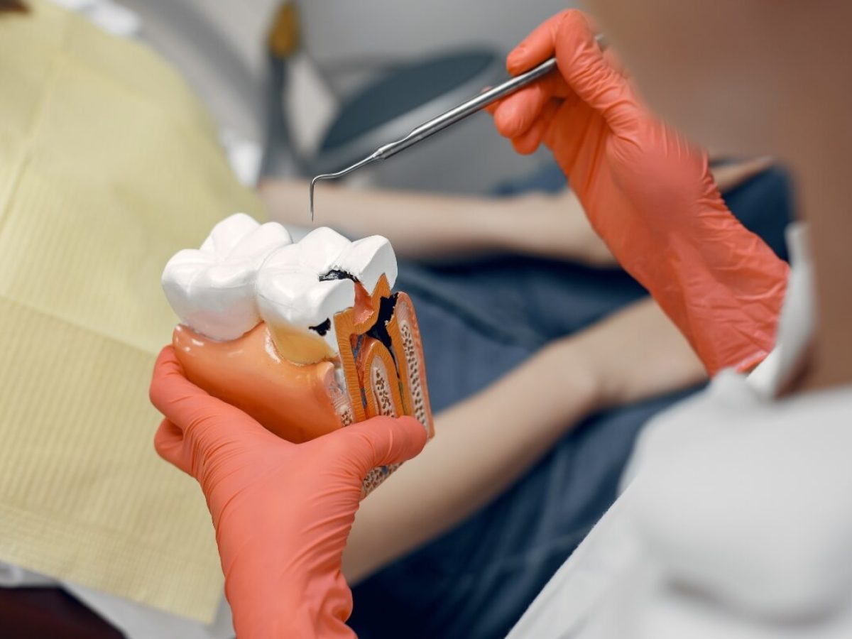diferencia entre endodoncia y ortodoncia