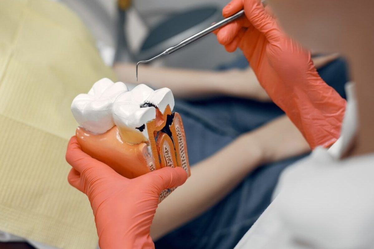 diferencia entre endodoncia y ortodoncia